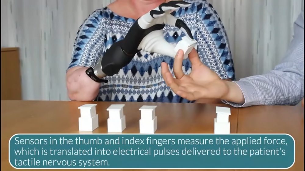 Bionic hand sensors